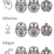 Brain regions in which the microstructure was associated with post-COVID-condition associated symptoms. Image courtesy of Alexander Rau, MD.
