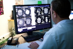 Radiologist Brain Scans Monitor