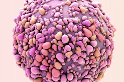Breast Cancer Cell2 400