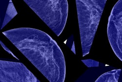 Breast Mammo 400 (1)