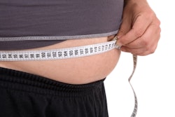 Obesity