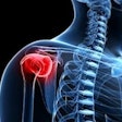 Shoulder