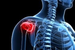 Shoulder