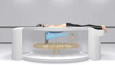 An illustration of a patient positioned on a Koning Vera Breast CT scanner. Image courtesy of Koning Health.