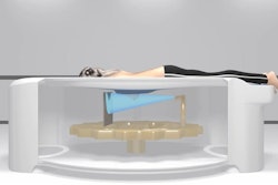 An illustration of a patient positioned on a Koning Vera Breast CT scanner. Image courtesy of Koning Health.