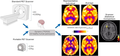 A visual abstract describing a comparison between a portable PET scanner and standard PET scanner. Image courtesy of the Journal of Nuclear Medicine.