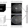 An illustration of two types of adversarial attacks on breast imaging diagnosis. Adversarial noise applied in white-box attacks and adversarial samples produced by generative adversarial networks in black-box attacks can fool a deep learning diagnostic model to give wrong output, according to University of Pittsburgh researchers. The researchers have proposed two security schemes, called ARFL and LIDA, to make the models robust and resilient to adversarial attacks. (Image courtesy of Shandong Wu, PhD, Pittsburgh Center for AI Innovation in Medical Imaging)