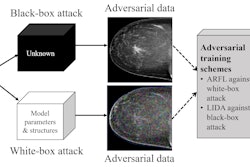 An illustration of two types of adversarial attacks on breast imaging diagnosis. Adversarial noise applied in white-box attacks and adversarial samples produced by generative adversarial networks in black-box attacks can fool a deep learning diagnostic model to give wrong output, according to University of Pittsburgh researchers. The researchers have proposed two security schemes, called ARFL and LIDA, to make the models robust and resilient to adversarial attacks. (Image courtesy of Shandong Wu, PhD, Pittsburgh Center for AI Innovation in Medical Imaging)