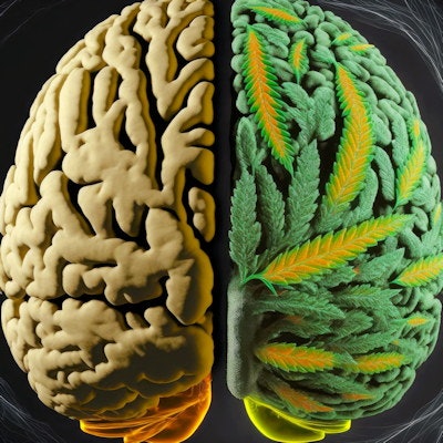 Am 2023 06 05 17 38 6592 Cannabis Brain 400