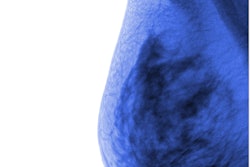 Breast Cancer2