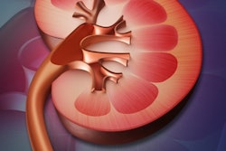 Kidney 400