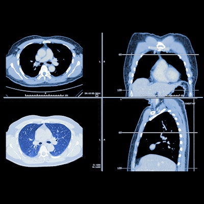 Zapalenie płuc w tomografii komputerowej?  Rozważ dodatkowe badania obrazowe, aby nie przeoczyć raka