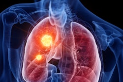 Lung Cancer Hotspot