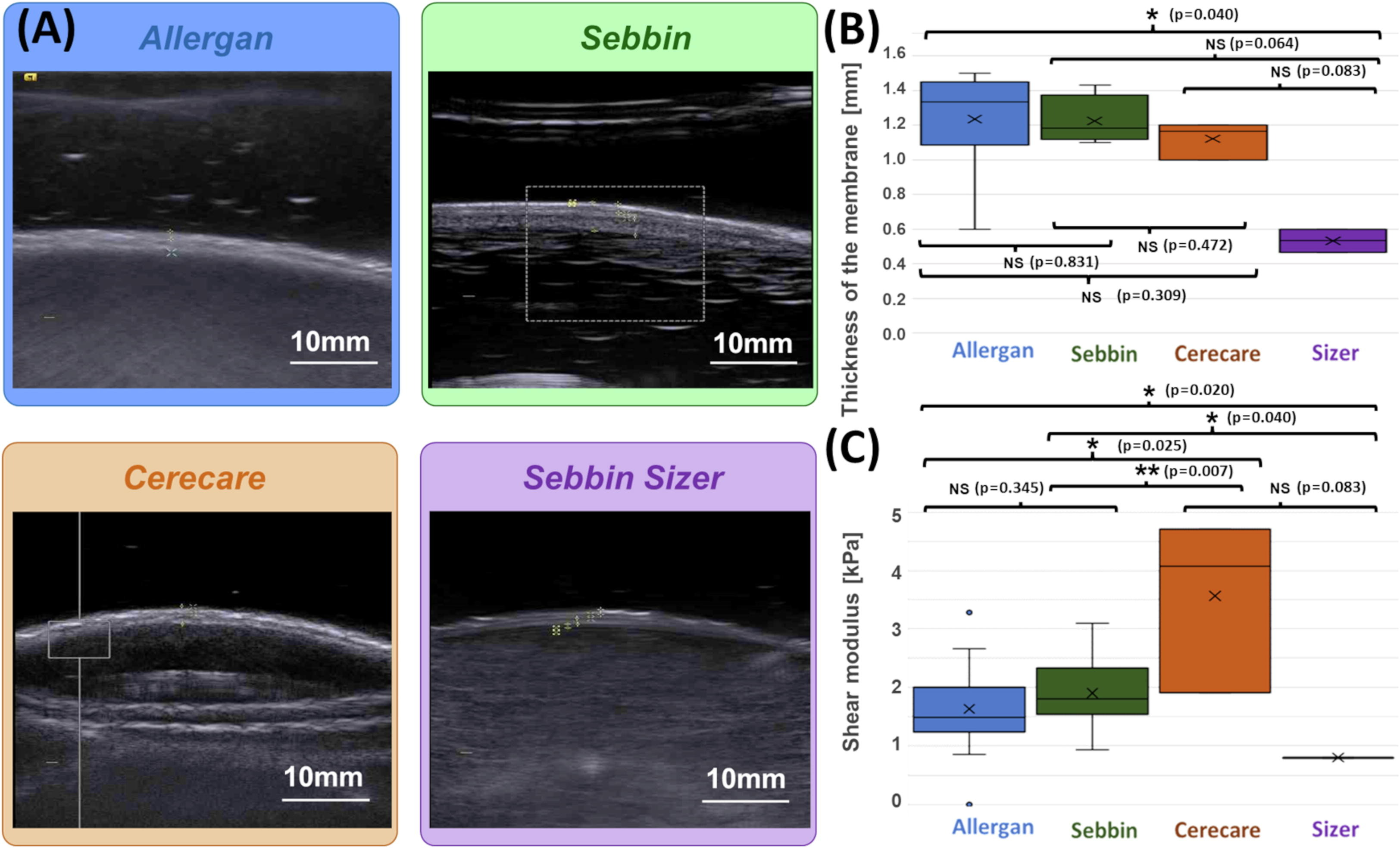 (A) Examples of B-mode images for the measurement of membrane thickness of implants from each of the four types of implants. Images are presented at the same scale. Membrane thicknesses (B) and then shear moduli measured by ARFI method (C) are compared without dissociation as a function of prosthesis age or implantation time. (NS: p-value > 0.05, *: p-value < 0.05, **: p-value < 0.01, ***: p-value < 0.001). Images are available for republishing under a Creative Commons license (CC BY-NC-ND 4.0 Deed) and courtesy of the Journal of Biomechanics.