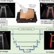 Workflow diagram showing real-time lung ultrasound segmentation with U-Net. Images available for republishing under Creative Commons license (CC BY 4.0 DEED, Attribution 4.0 International) and courtesy of Ultrasonics.