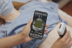 Clarius Bladder AI measures bladder volume and provides real-time feedback to clinicians. It recently received 510(k) clearance from the FDA. Image courtesy of PR Newswire.