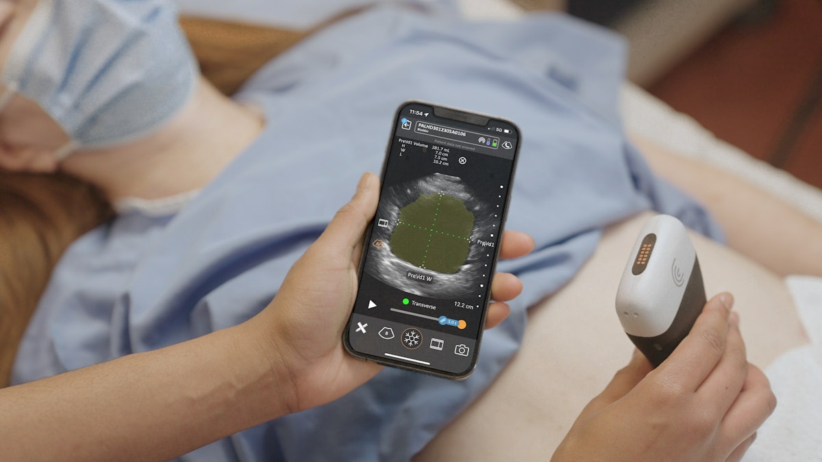 GE HealthCare's wireless patient monitoring device secures FDA clearance -  Medical Device Network
