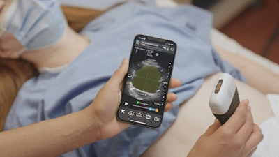 Clarius Bladder AI measures bladder volume and provides real-time feedback to clinicians. It recently received 510(k) clearance from the FDA. Image courtesy of PR Newswire.