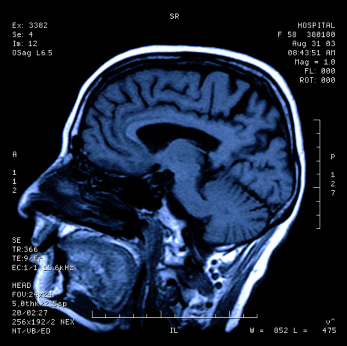 Mri Head