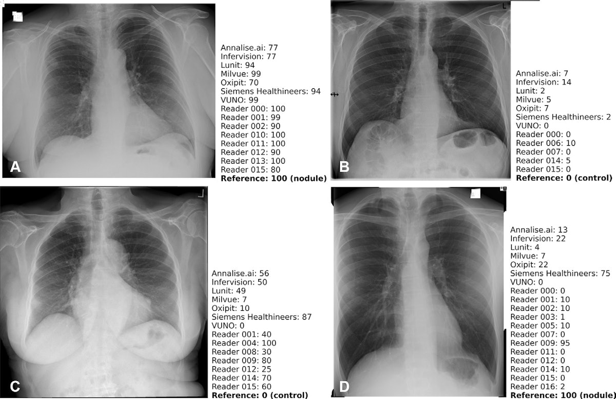 Muller's Imaging of the Chest - 2nd Edition | Elsevier Shop