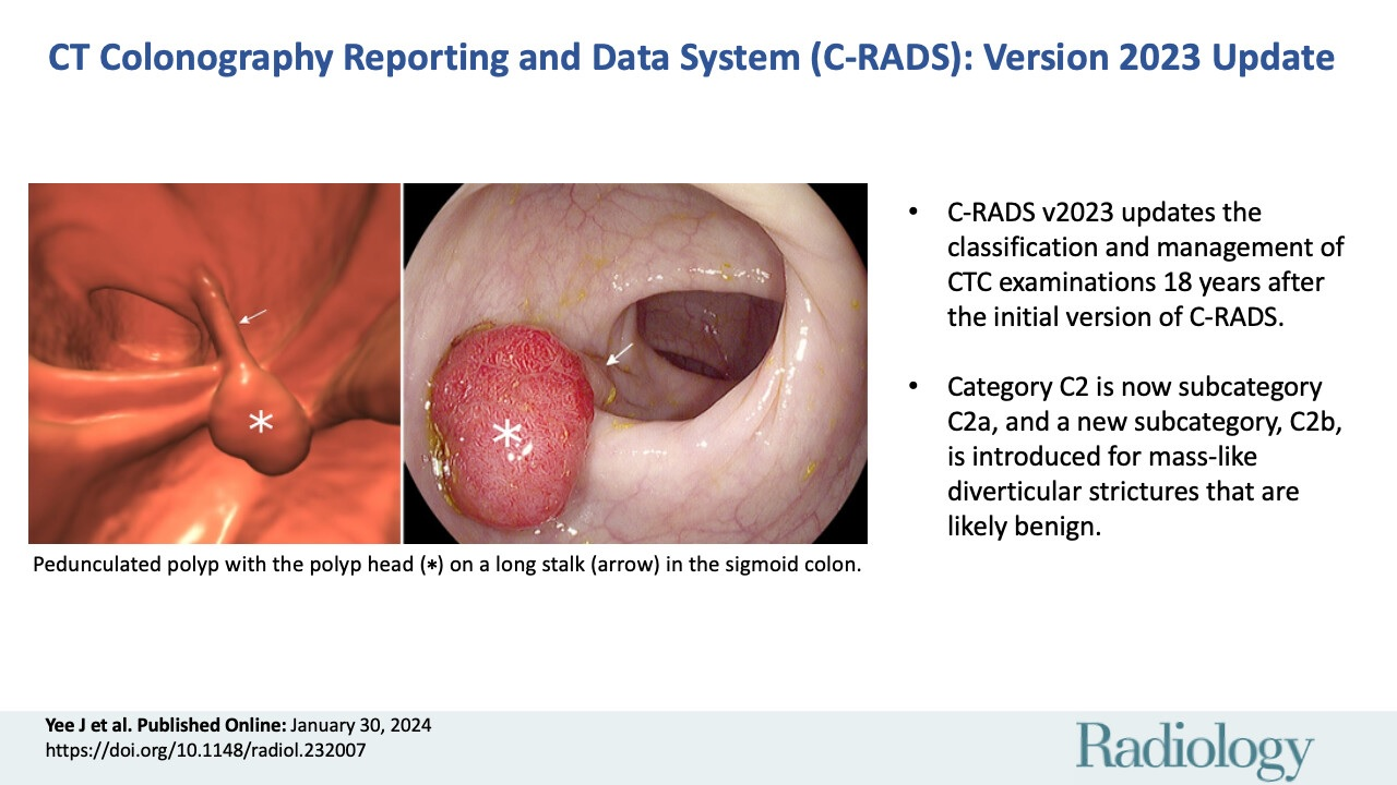 Graphical abstract of the C-RADS update. Image courtesy of RSNA.