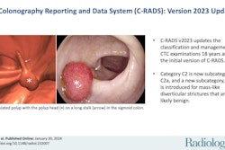Graphical abstract of the C-RADS update. Image courtesy of RSNA.