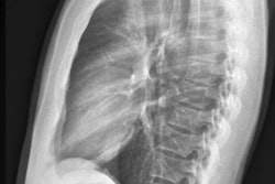 Chest X Ray Lateral View 400