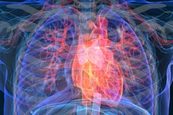 Heart Attack Disease 3 D 400