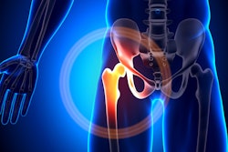 Hip Joint