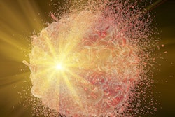 Radiotherapy2 400
