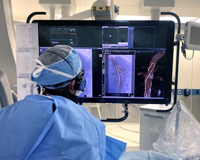 Philips is making its LumiGuide system available to specialized hospitals in Europe and the U.S. The system is guided by light rather than x-ray for complex aortic procedures. Image courtesy of Philips.