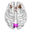 Image showing bilateral cuneal (magenta) and frontal cortex (brown). Courtesy of eLife/University of Cambridge.
