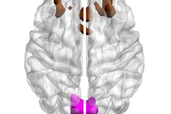 Image showing bilateral cuneal (magenta) and frontal cortex (brown). Courtesy of eLife/University of Cambridge.