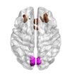 Image showing bilateral cuneal (magenta) and frontal cortex (brown). Courtesy of eLife/University of Cambridge.