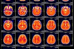 Mri Slide 400