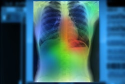 Artificial Intelligence Lung Color (1)