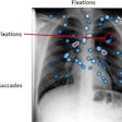 Difference between saccades, fixations, and attention heatmaps in radiologist eye-tracking studies. Image courtesy of the European Journal of Radiology.