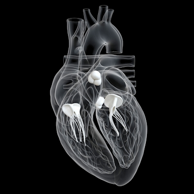 Heart Valves 3 D 400