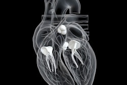 Heart Valves 3 D 400