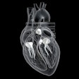 Heart Valves 3 D 400
