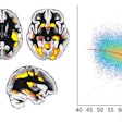 To the left of the figure, the red-yellow color denotes the regions that degenerate earlier than the rest of the brain and are vulnerable to Alzheimer’s disease. These brain areas are higher-order regions that process and combine information coming from our different senses. To the right of the figure, each dot represents the brain data from one UK Biobank participant. The overall curve shows that, in these particularly fragile regions of the brain, there is accelerated degeneration with age. Image courtesy of Gwenaëlle Douaud, PhD, and Jordi Manuello, PhD.