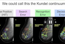 A continuum of errors related to image perception. Image courtesy of Jeremy Wolfe, MD.