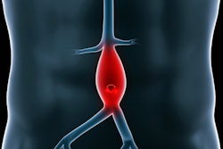 Abdominal Aneurysm 400