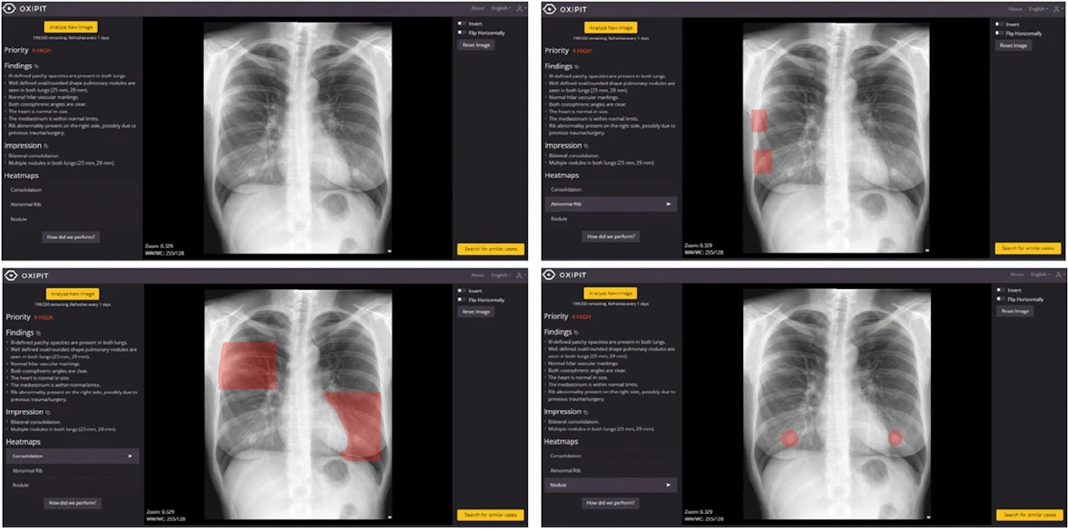 Study calls for improvement of commercial AI algorithms Study calls for improvement of commercial AI algorithms