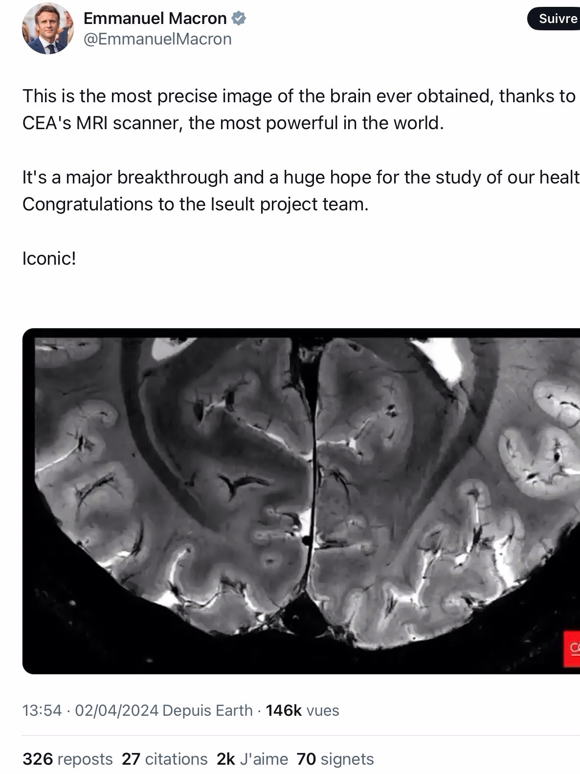 French-led team unveils 11.7 tesla MRI scans of human brain | AuntMinnie