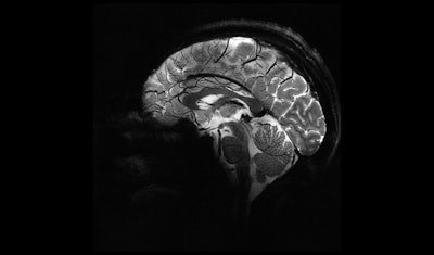 Сагиттальная проекция мозга при 11,7 тесла позволяет визуализировать мозжечок в очень мелких деталях.