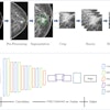 Researchers explain the data preparation and structure of a proposed CNN-based deep learning model using mammography features to determine breast tumor staging. The image is available for use under a Creative Commons license: CC BY-NC-ND 4.0 DEED Attribution-NonCommercial-NoDerivs 4.0 International.