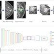 Researchers explain the data preparation and structure of a proposed CNN-based deep learning model using mammography features to determine breast tumor staging. The image is available for use under a Creative Commons license: CC BY-NC-ND 4.0 DEED Attribution-NonCommercial-NoDerivs 4.0 International.