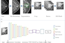 Researchers explain the data preparation and structure of a proposed CNN-based deep learning model using mammography features to determine breast tumor staging. The image is available for use under a Creative Commons license: CC BY-NC-ND 4.0 DEED Attribution-NonCommercial-NoDerivs 4.0 International.