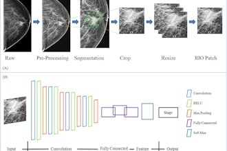 Researchers explain the data preparation and structure of a proposed CNN-based deep learning model using mammography features to determine breast tumor staging. The image is available for use under a Creative Commons license: CC BY-NC-ND 4.0 DEED Attribution-NonCommercial-NoDerivs 4.0 International.